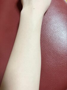 スムーズスキンの効果の画像（腕）